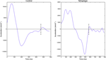 Primary and submovement control of aiming in C6 tetraplegics following posterior deltoid transfer